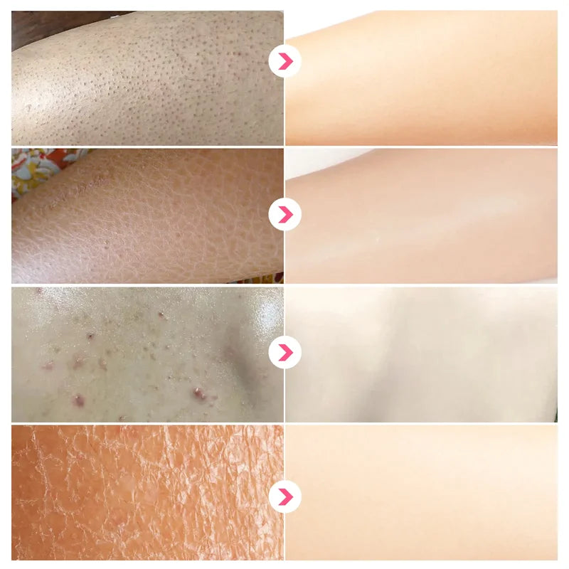 GlowBody Smoothing & Brightening Cream – Strawberry Legs & Rough Skin Fix