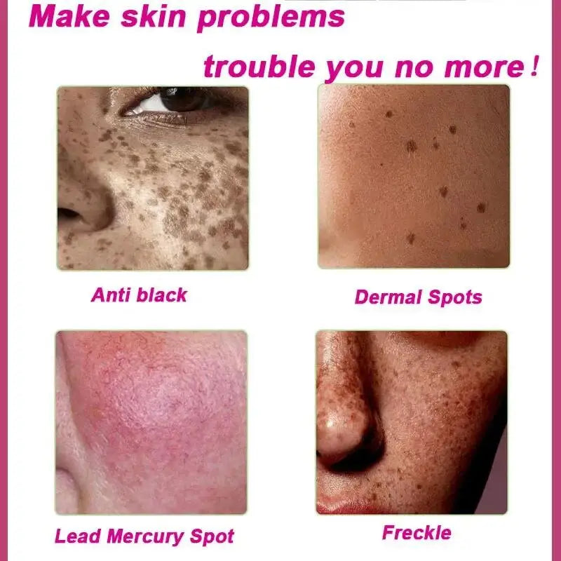 AstroGlow Dark Spot Corrector & Whitening Brightening Cream
