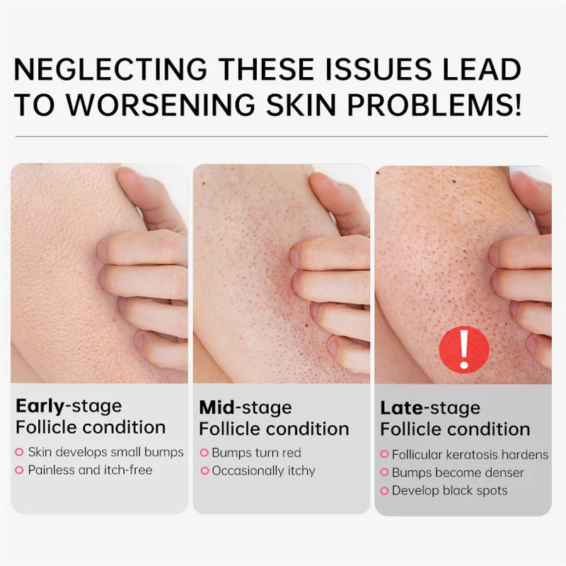 GlowBody Smoothing & Brightening Cream – Strawberry Legs & Rough Skin Fix