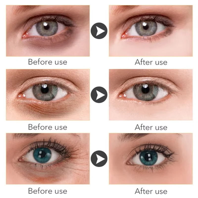 EyeRevive Retinol Dark Circle & Eye Bag Serum