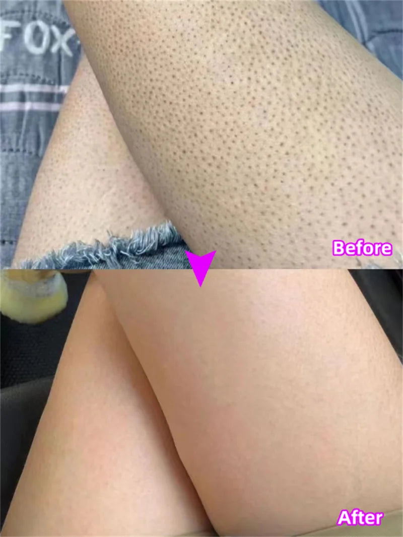 GlowBody Smoothing & Brightening Cream – Strawberry Legs & Rough Skin Fix