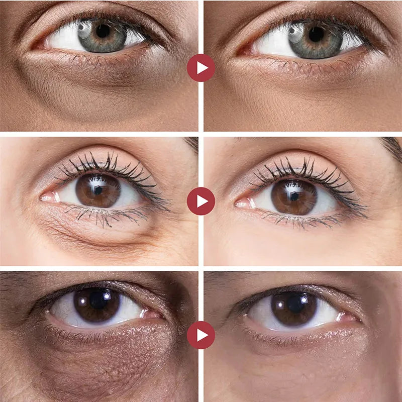 Eye Dark Circles Remover Cream Retinol Anti-aging Serum Remove Eye Bags Puffiness Fade Wrinkles Fine Lines Lift Firm Eye Care